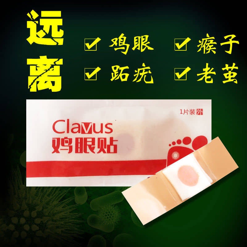 06 Miếng dán điều trị vết chai và mụn cóc trên lòng bàn chân