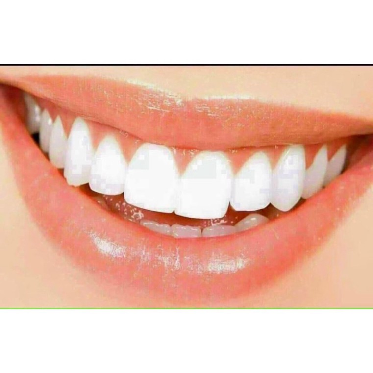 [Hàng Mỹ ] Kem đánh răng Colgate siêu trắng 181gram