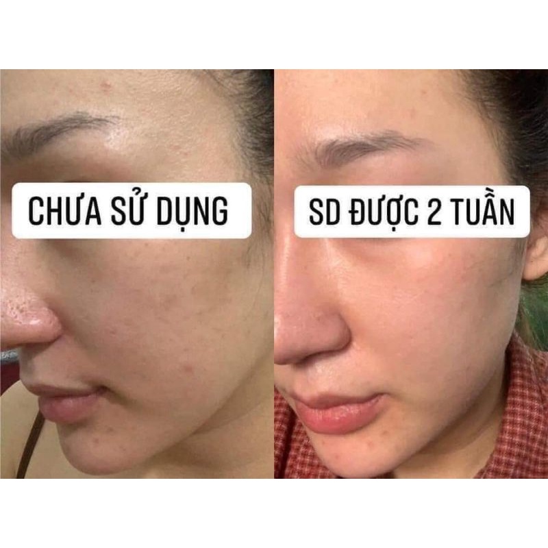 SERUM HYDRAB5 HEMIA- NHAU THAI HEO ĐỈNH CAO DƯỠNG ẨM- PHỦ SƯƠNG CĂNG BÓNG | BigBuy360 - bigbuy360.vn
