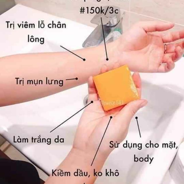 Bánh xp cho da mụn