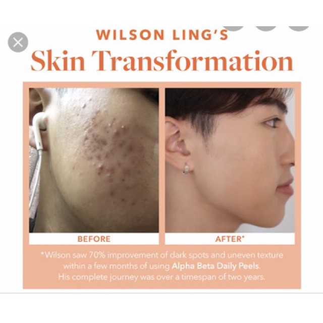 Tẩy Da Chết Tái Tạo Da Dr. Dennis Gross Skincare Alpha Beta® Peel Extra Strength Daily Peel | BigBuy360 - bigbuy360.vn