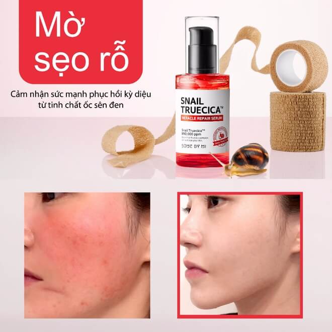 Nước hoa hồng Ốc Sên Some By Mi Snail Truecica Miracle Repair Toner cao cấp