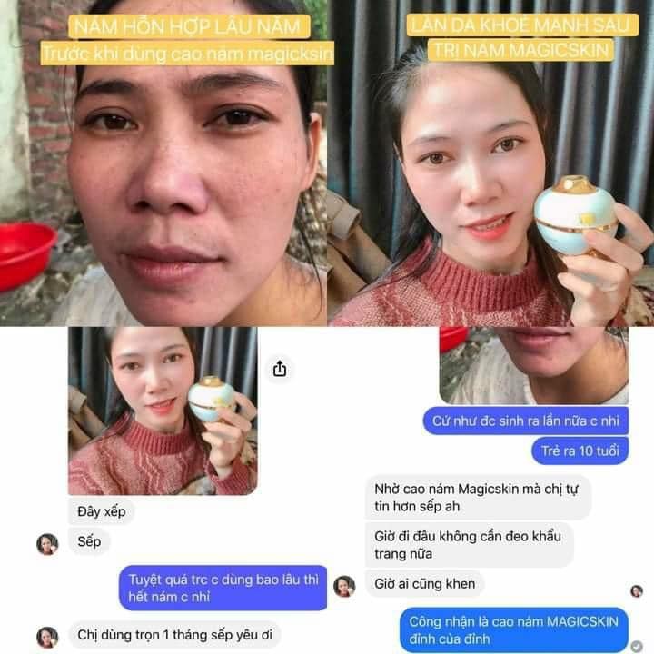 [Chính Hãng] Cao Nám Kem Ngừa Nám Tàn Nhang MagicSkin Royal Melasma Plus (size lớn) | BigBuy360 - bigbuy360.vn