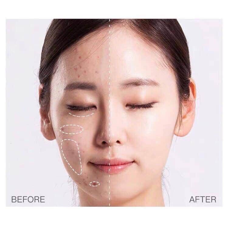 (chính hãng) Kem lót che khuyết điểm DEMYSELF 30g | BigBuy360 - bigbuy360.vn