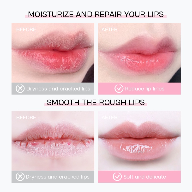 Mặt nạ môi giảm nếp nhăn môi hoa anh đào Nhật Bản Laikou 8g LAIKO nội địa trung LKMN011