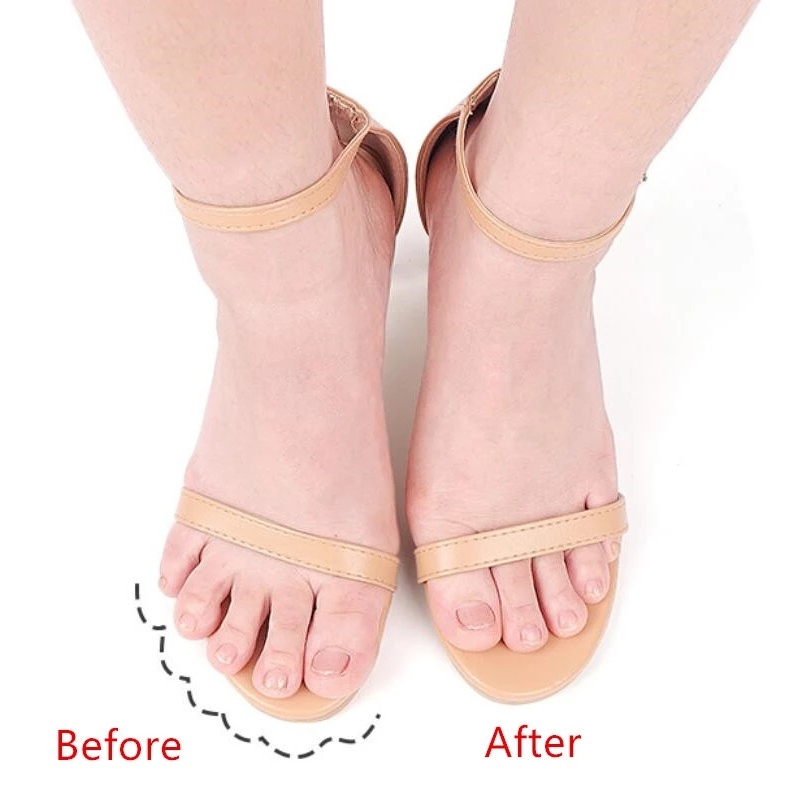 Set 2 Miếng Đệm Chân Chống Trượt Dành Cho Giày Cao Gót Tiện Dụng