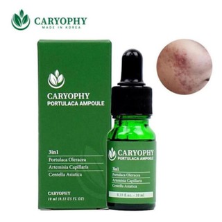Serum Trị Mụn Thâm Dành Cho Da Nhờn Caryophy 1ml