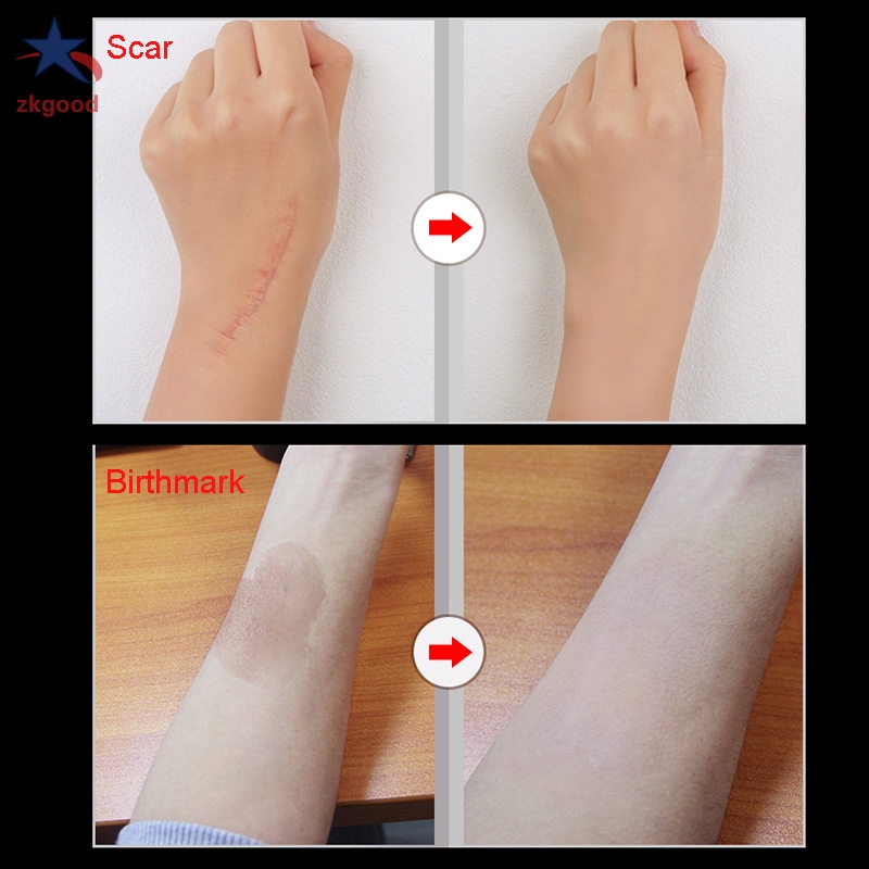 Bộ 2 kem che khuyết điểm trang điểm da giúp che phủ hình xăm tiện dụng