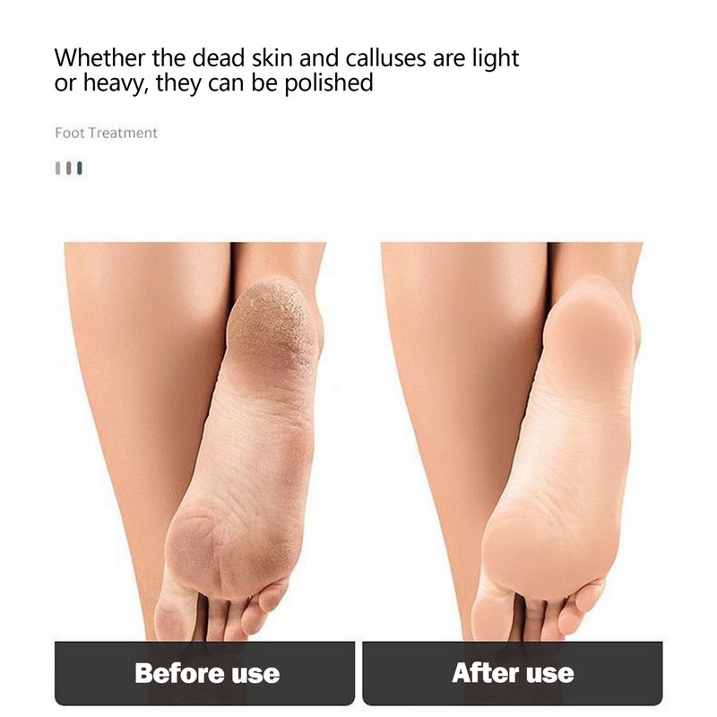 Dụng Cụ Tẩy Tế Bào Chết Cho Chân Cứng Chất Lượng Cao