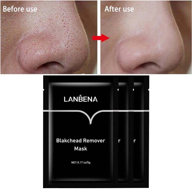 Mặt Nạ Lột Mụn Đầu Đen Lanbena Hiệu Quả Dễ Sử Dụng