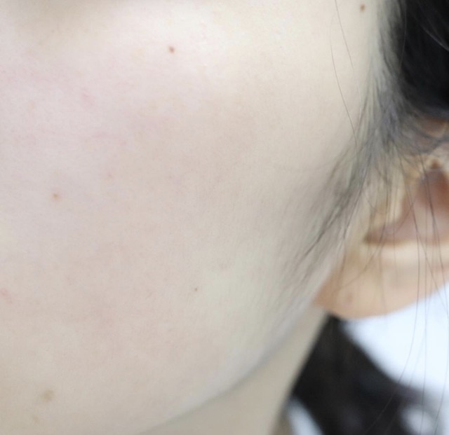 Tẩy da chết dạng kỳ Primera Peeling Facial Mild 150ml | BigBuy360 - bigbuy360.vn