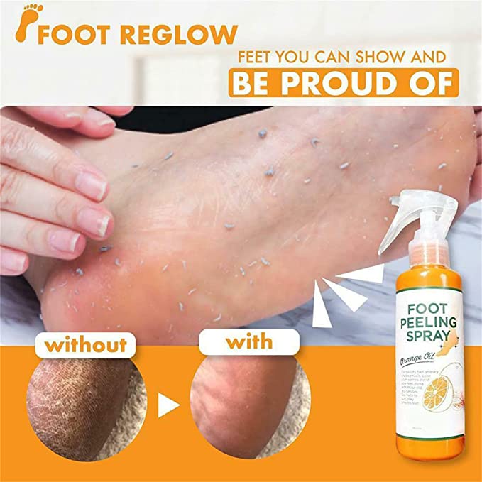 Tẩy Tế Bào Chết Chân, Khuỷu Tay, Đầu Gối Dạng Xịt Foot Peeling Spray Orange Oil