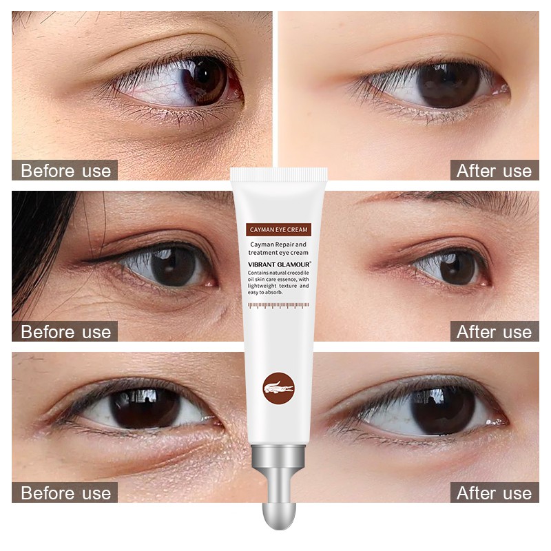 Bộ kem dưỡng mắt VIBRANT GLAMOUR chứa collagen peptide axit hyaluronic cải thiện nếp nhăn và quầng thâm
