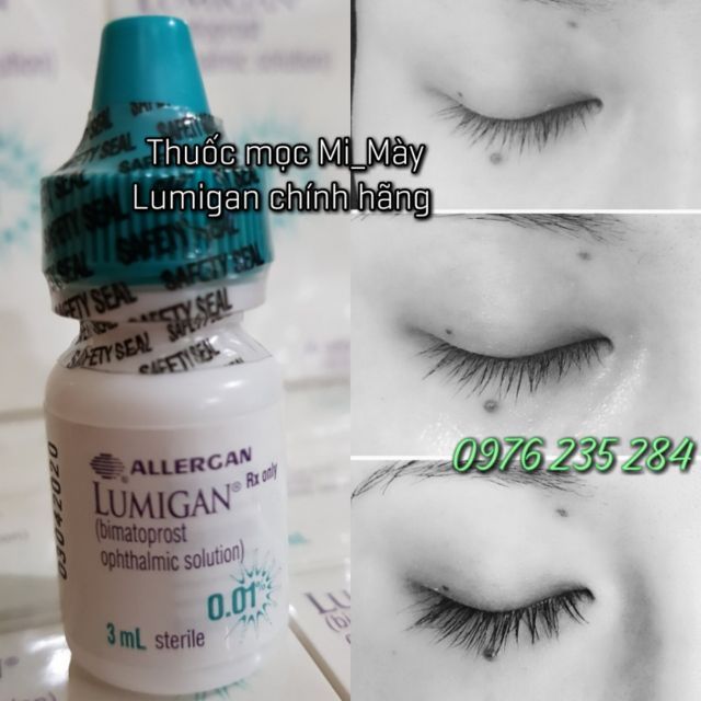 Lumigan Thuốc mọc dài mi của Mỹ