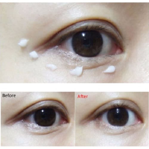 Kem Dưỡng Ẩm Mắt Và Giảm Thâm Quầng Mắt Secret Key Starting Treatment Eye Cream 30g