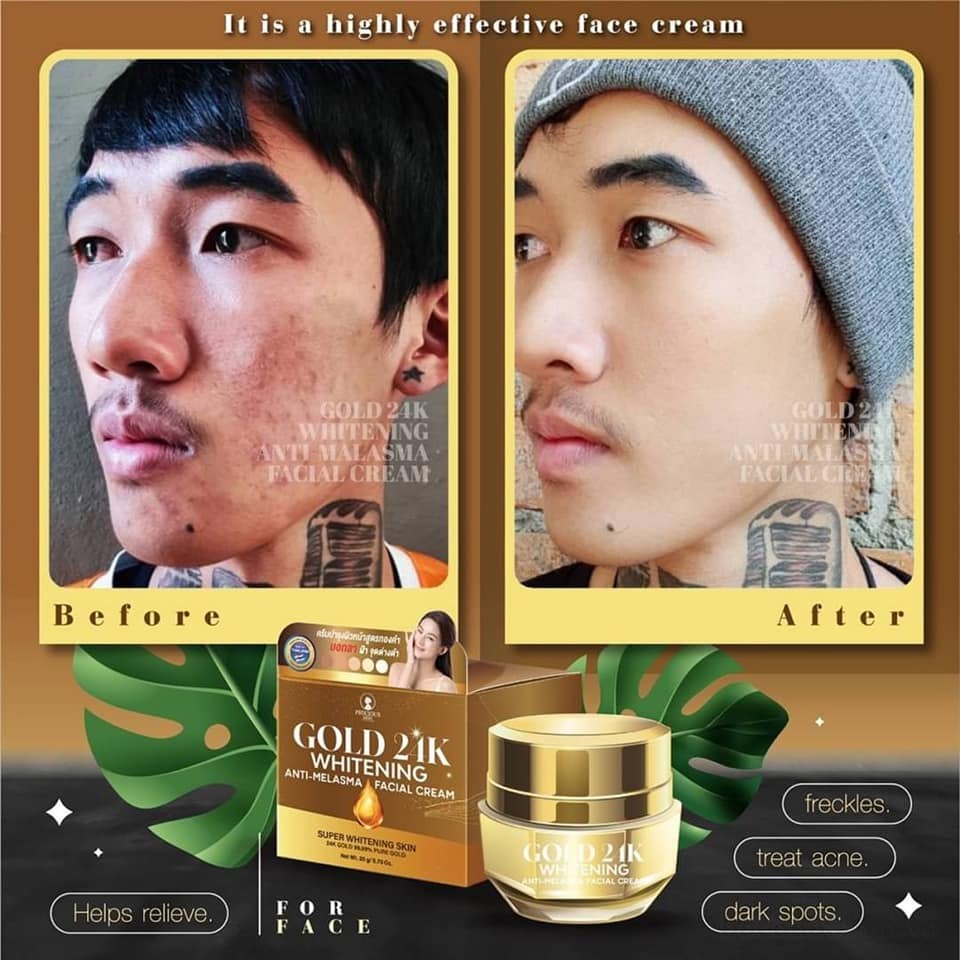 Gold 24K whitening Anti-Melasma Facial Cream Kem dưỡng trắŉg da ngừa ņám