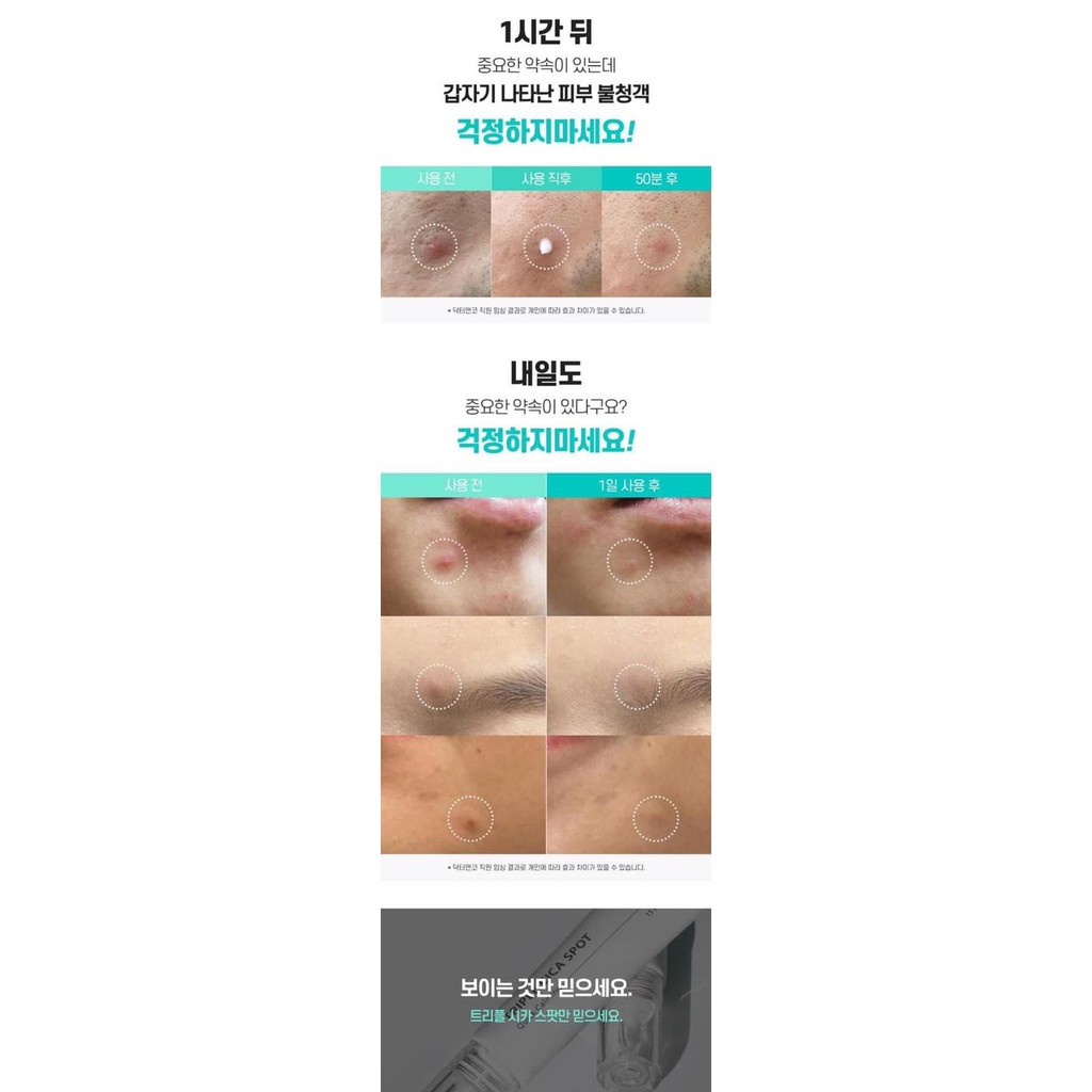 Tinh chất chấm mụn Triple CiCa Spot