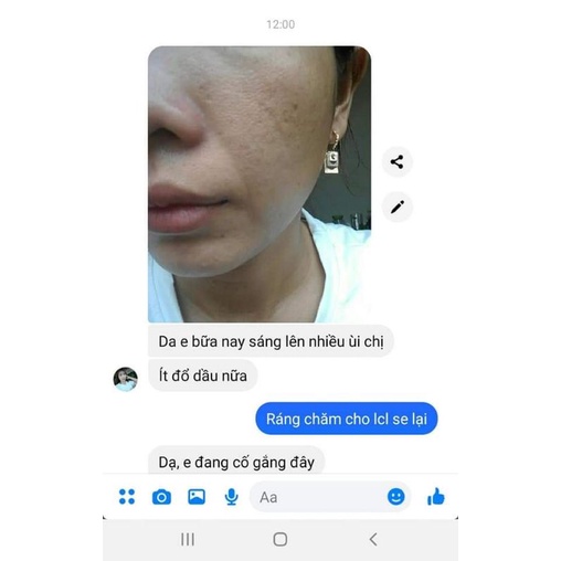 Tự nhiên 100% Nước Hoa Hồng | Thế Giới Skin Care