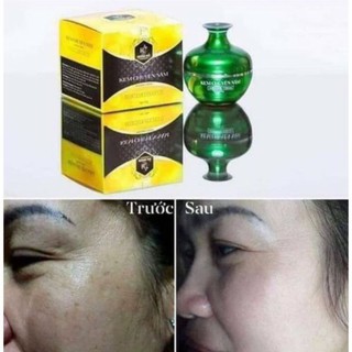 KEM NÁM HUỲNH ĐỖ