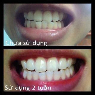 Bột Than Tre Trắng Răng Tanoshi
