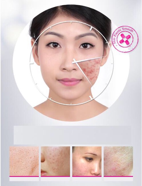 Kem Mụn Bioaqua Pure Skin Hàng Nội Địa Trung | WebRaoVat - webraovat.net.vn