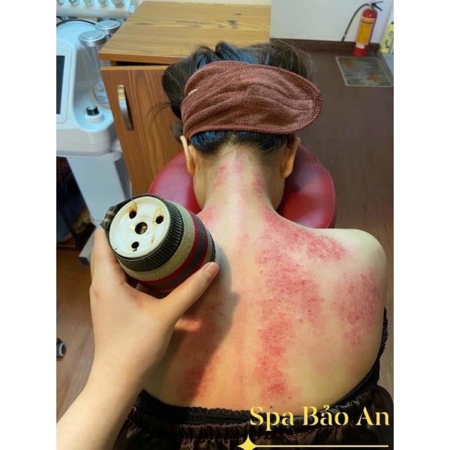 Cốc Phù Dương trị liệu kèm ngải