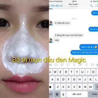 GEL LỘT MỤN ĐẦU ĐEN Magic