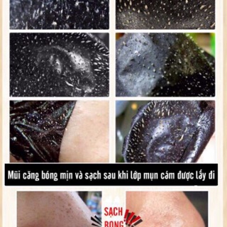 GEL hút mụn hoạt tính than tre