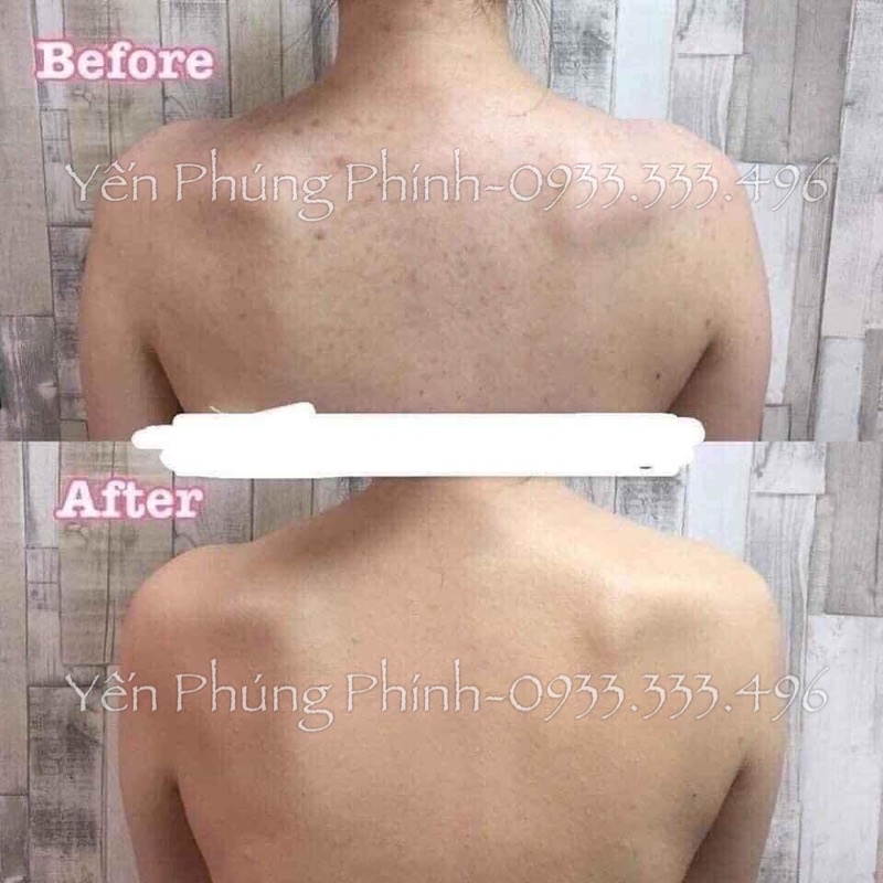 Xà Phòng Cám Gạo Thái Lan