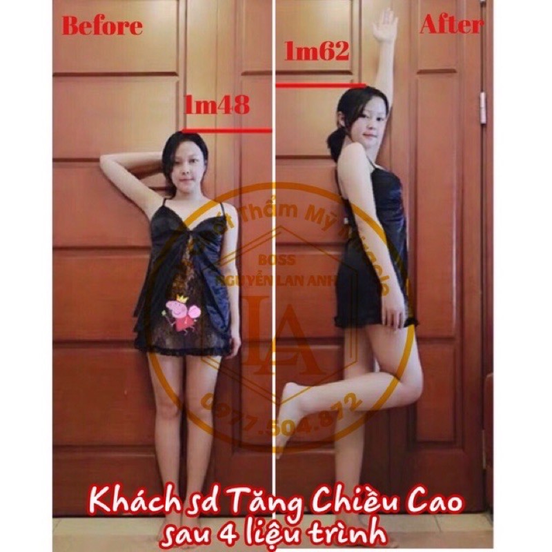 Tinh chất tăng chiều cao Miracle - Pháp, hiệu quả chỉ sau 1 tháng (30ml)