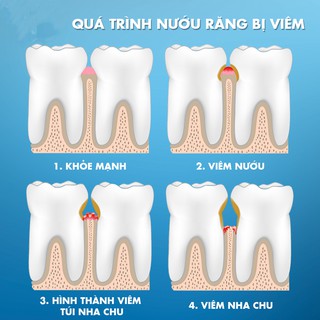 KEM ĐÁNH RĂNG KF