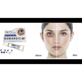 Kem dưỡng mắt Kumargic Nhật Bản