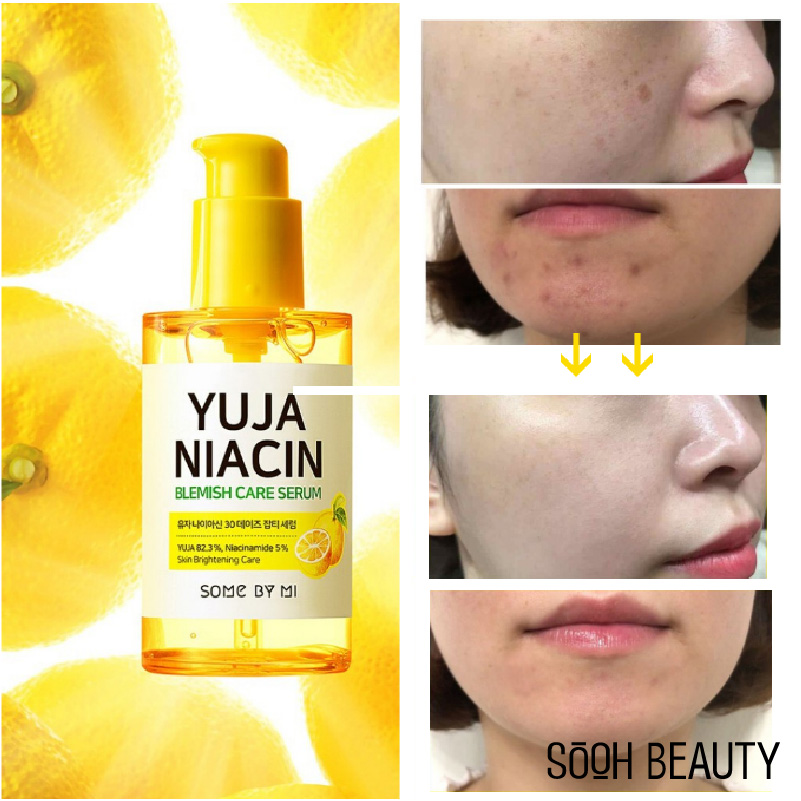 SOME BY MI Serum trị mụn Somebymi Yuja Niacin 50ml