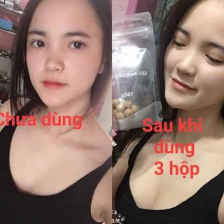 Sỉ 5 hộp kẹo mầm lúa mạch gold