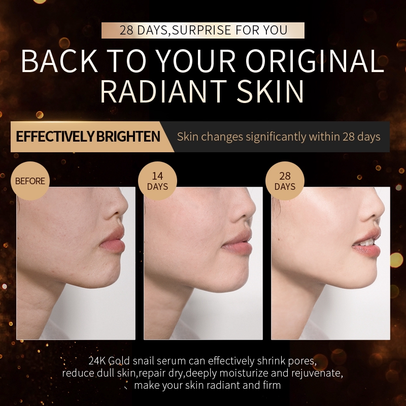 Serum Ốc Sên Vàng LAIKOU 24k Dưỡng Da Chống Lão Hóa Làm Săn Chắc Mịn Màng 17ml