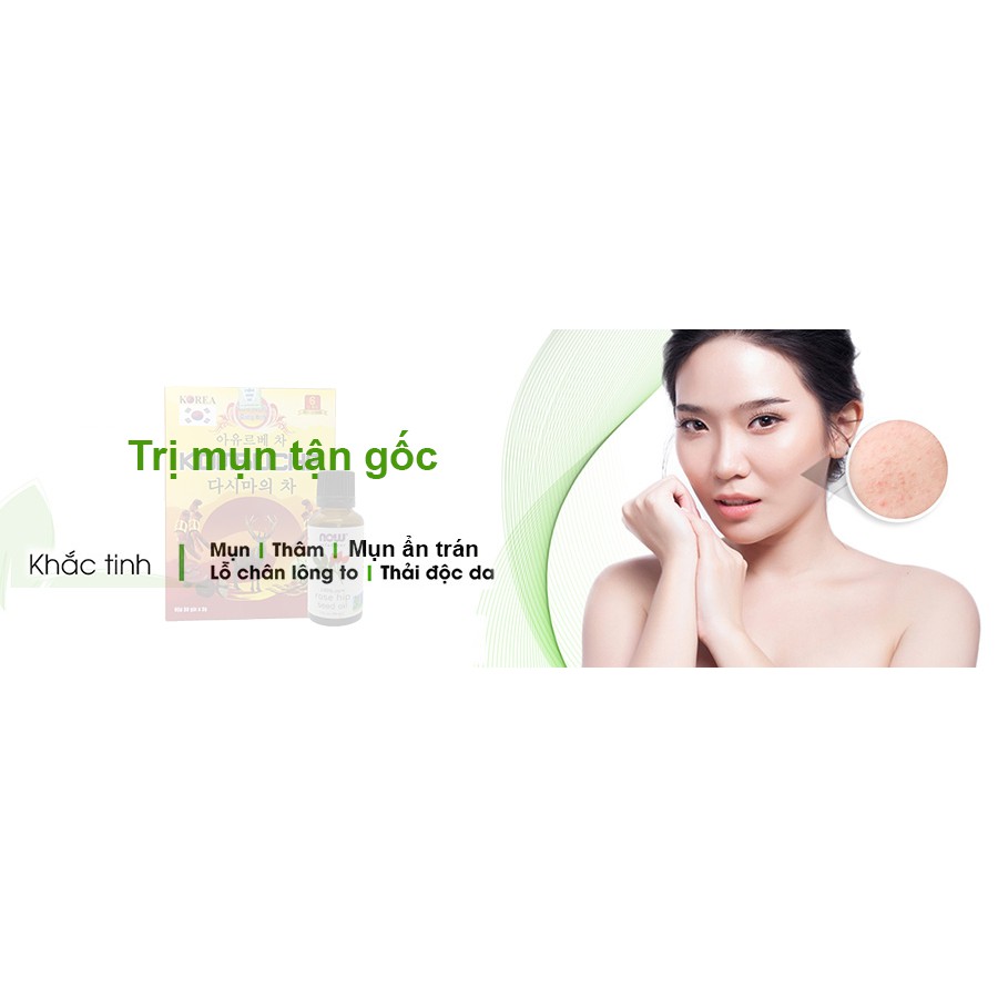 Combo tinh dầu tầm xuân Rosehip Seed Oil