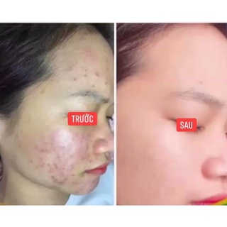 Noãn thực vật .