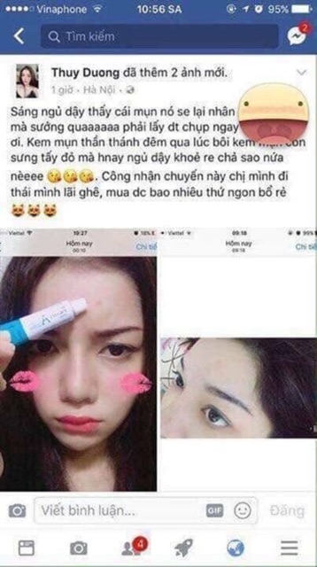 Kem mụn Retin-A Thái Lan