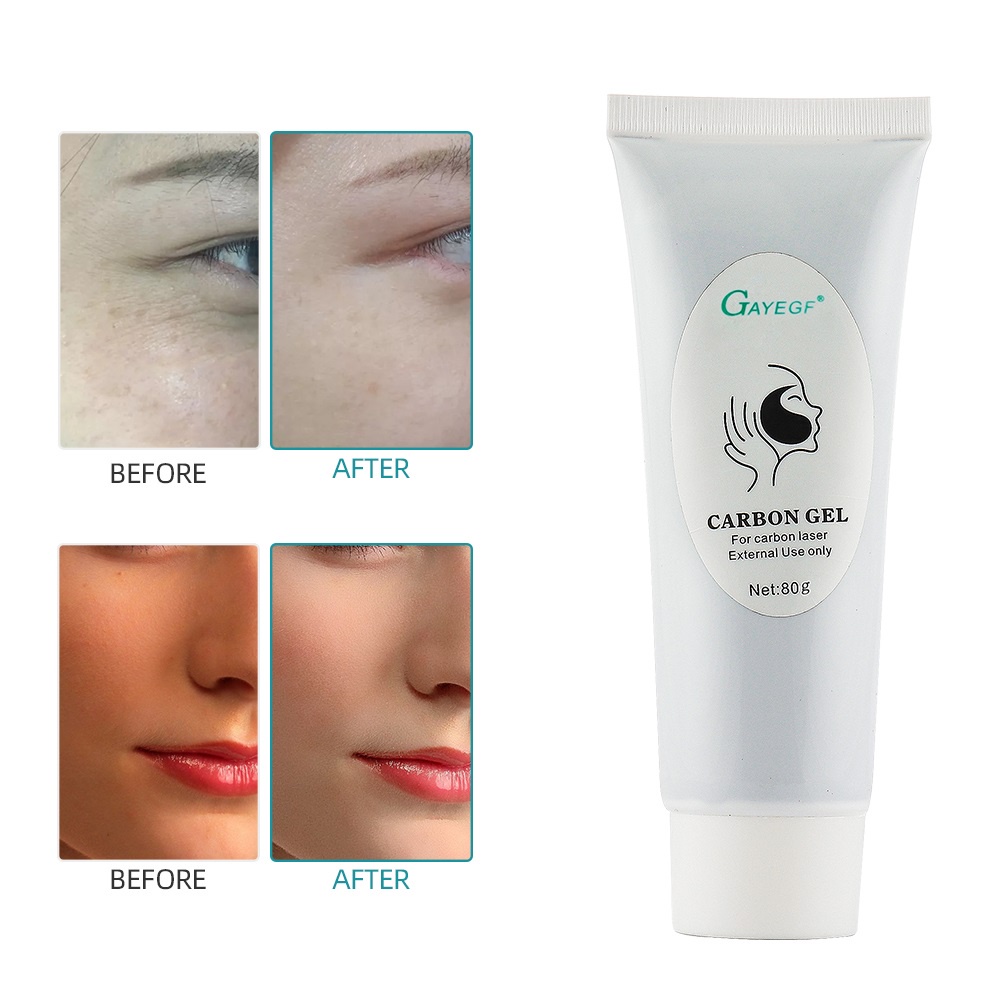 Gel carbon laser ForeverLily mềm mại làm trắng da chăm sóc da mặt