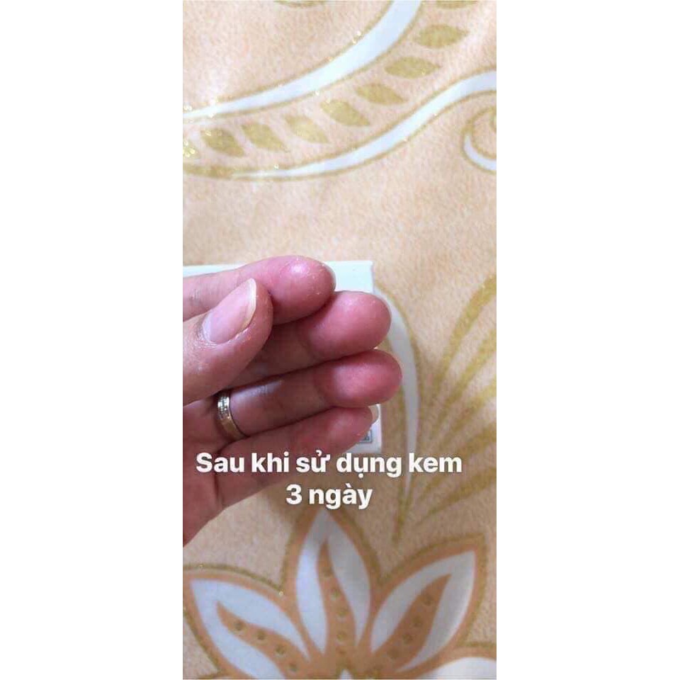 Kem trị á sừng keratinamin nội địa Nhật | BigBuy360 - bigbuy360.vn