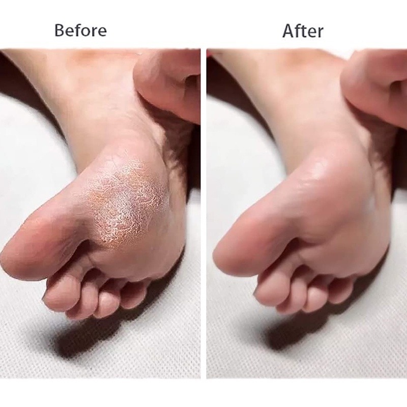 [Hàng mới về] Dụng cụ chà gót chân hai mặt tẩy tế bào chết chuyên nghiệp