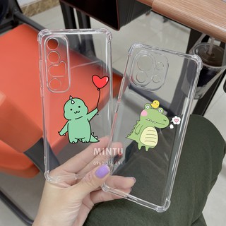 Ốp Xiaomi Redmi Note 10 / Redmi Note 10 Pro / Redmi Note 9 5G - trong suốt chống sốc bảo vệ camera TS362 - TS363