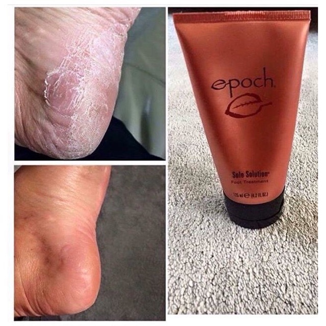 CHUYÊN SỈ NUSKIN] KEM TRỊ NỨT GÓT CHÂN - EPOCH SOLE SOLUTION FOOT 125ML