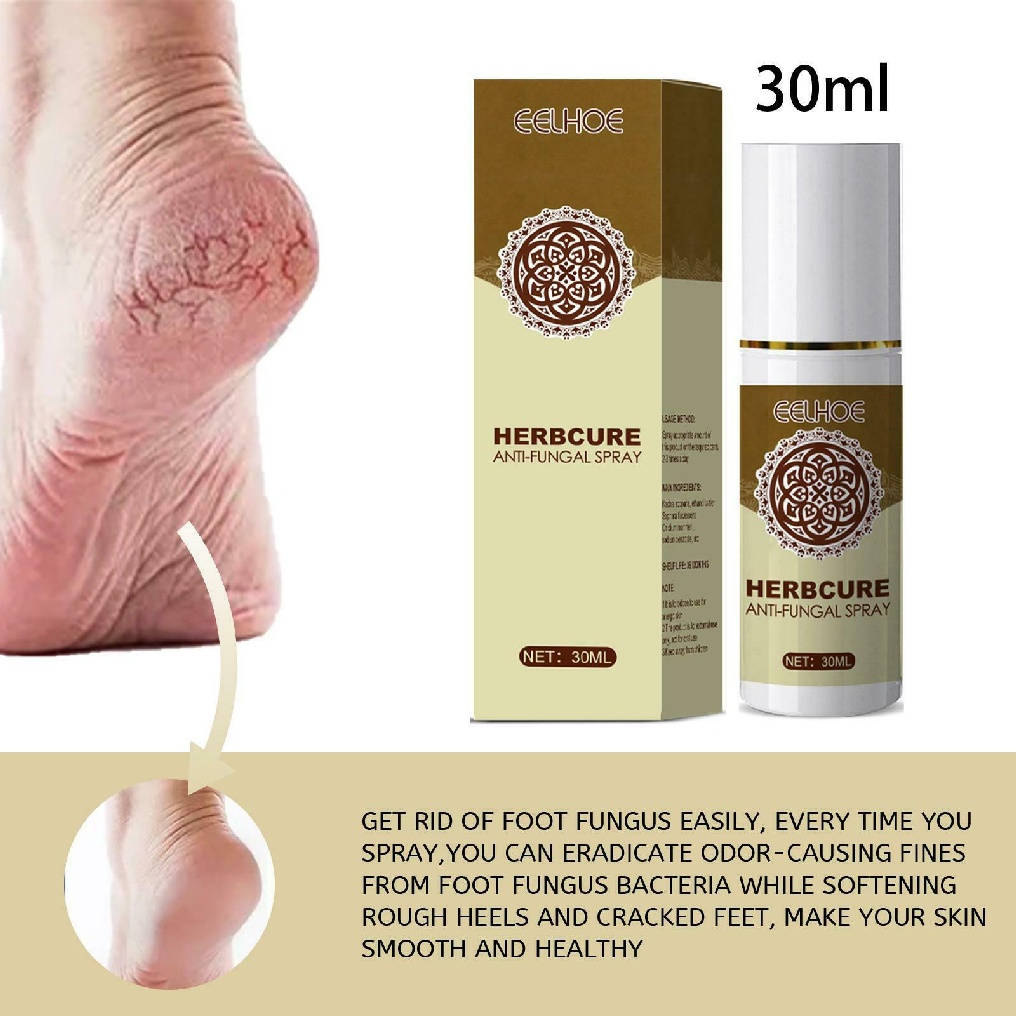 [Hàng mới về] Xịt dưỡng bàn chân thảo dược cải thiện tình trạng nấm chăm sóc làn da 30ml