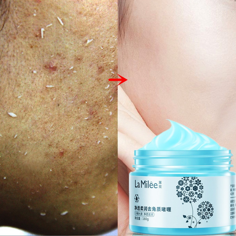 Gel Tẩy Tế Bào Chết Thu Nhỏ Lỗ Chân Lông Toàn Thân Chất Lượng Cao | BigBuy360 - bigbuy360.vn