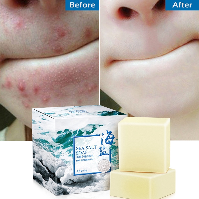 Xà phòng muối biển rửa mặt/tẩy trang/tẩy mụn đầu đen/trứng cá 100g | BigBuy360 - bigbuy360.vn