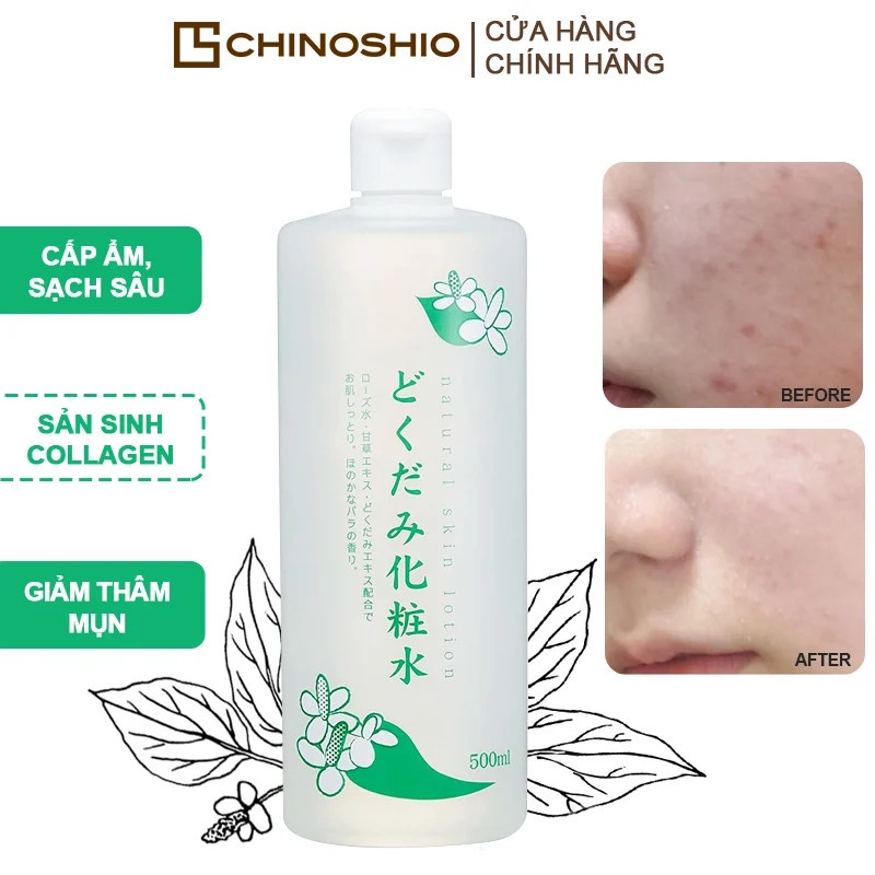 Toner Diếp Cá Dokudami Nhật Bản 500ml Chính Hãng Natural Skin Lotion - Nước Hoa Hồng Dưỡng Ẩm Mờ Vết Thâm Skincare Dezy