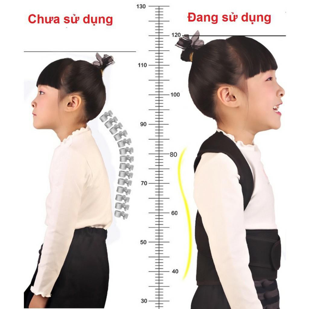 Đai Chống Gù Lưng Trẻ Em, Đai chống lưng tôm cho trẻ em Posture Corrector