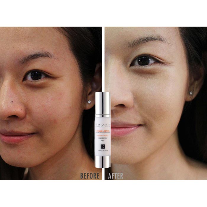 Kem Xóa Nám, MờThâm, Làm Sáng và Đều Màu Da  💓 RETINOL & VITAMIN C 💓 Mỹ Phẩm Cao Cấp Châu Âu | BigBuy360 - bigbuy360.vn