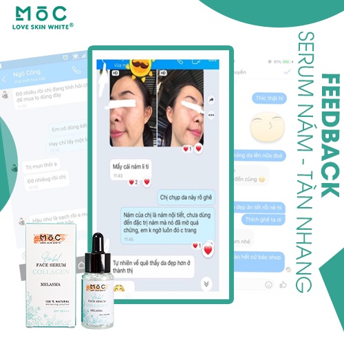 Tinh chất ngăn ngừa, làm giảm nám tàn nhang Collagen Mộc Love Skin White 25ml